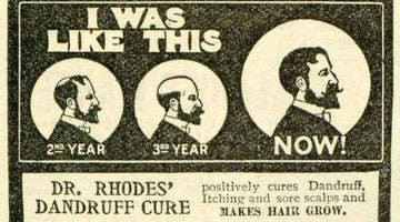 Fireside Topic: How do you handle hair loss (going bald)? - Wolf & Iron