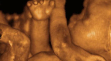 Man to Man: On Abortion - Wolf & Iron