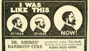 Fireside Topic: How do you handle hair loss (going bald)? - Wolf & Iron