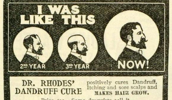 Fireside Topic: How do you handle hair loss (going bald)? - Wolf & Iron