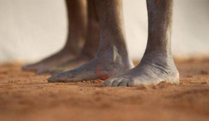 Free Your Feet – Part 2: The Humble Ankle - Wolf & Iron