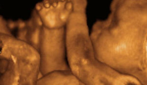 Man to Man: On Abortion - Wolf & Iron